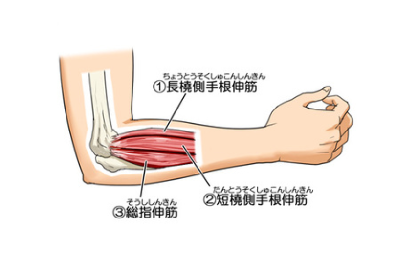 テニス肘のストレッチ方法とは！？（大田区久ヶ原のプライマリー ボディケア）